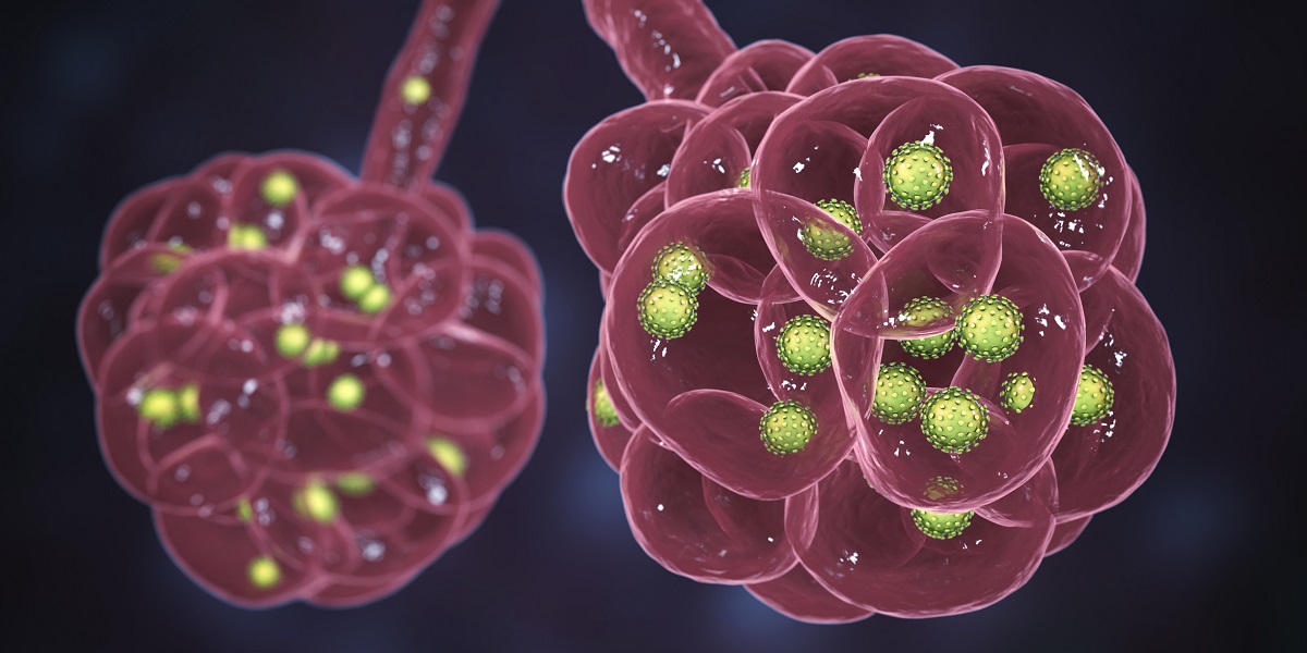 3D illustration and Photo Under Microscope of Metastatic Colorectal Cancer