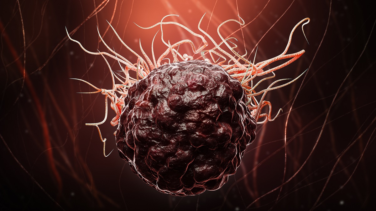 3D Rendering Lymphoma Tumor Cell