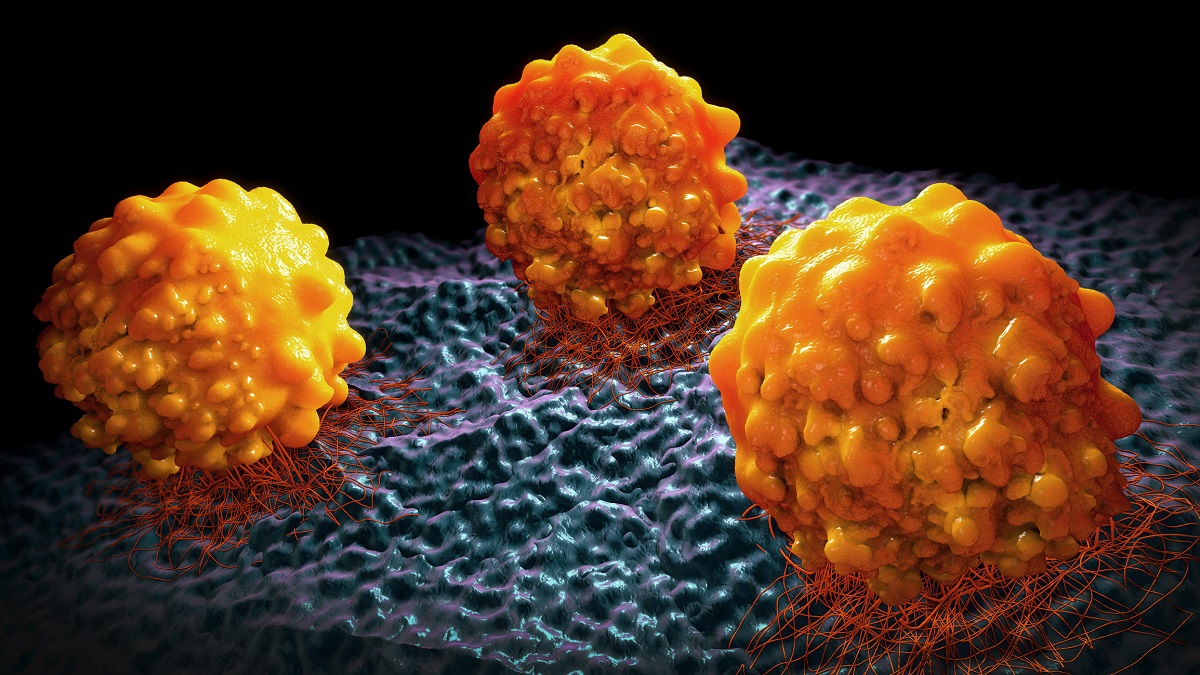 3d illustration of Lymphoma Cancer